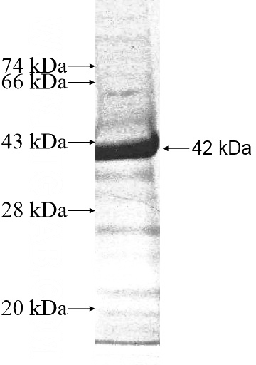 Recombinant Human RSPH10B SDS-PAGE