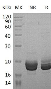 Human UBE2C/UBCH10 (His tag) recombinant protein