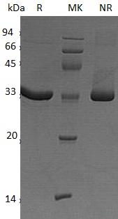 Human CA5B (His tag) recombinant protein