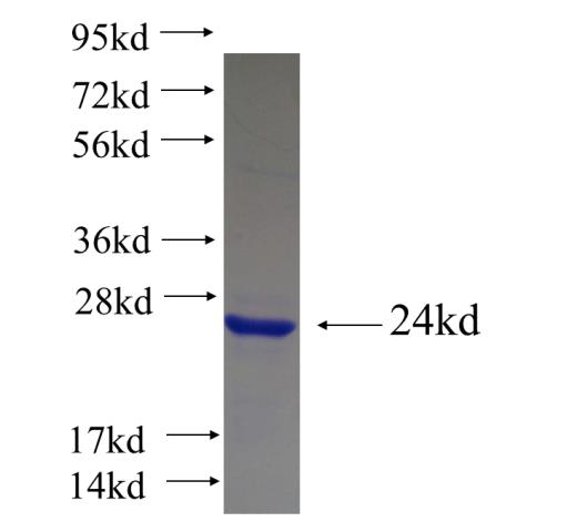 Recombinant Arabidopsis thaliana GFS1 SDS-PAGE