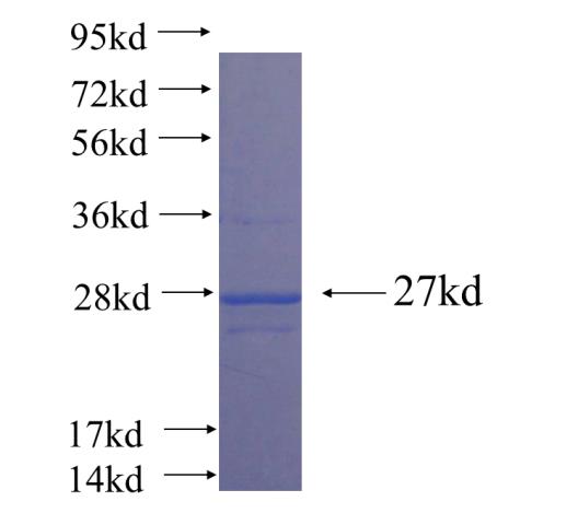 Recombinant human LRRC20 SDS-PAGE