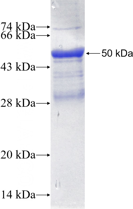 Recombinant Human IL-34 SDS-PAGE