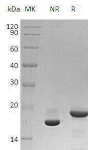 Human GH1 recombinant protein