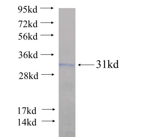 Recombinant human WDR74 SDS-PAGE