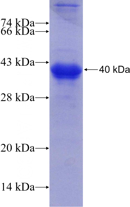 Recombinant Human UNG SDS-PAGE