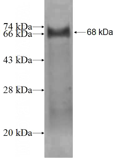 Recombinant Human SPOCK2 SDS-PAGE