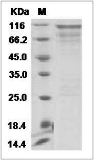 Human HER2 / ErbB2 / CD340 (676-1255) Protein (His & GST Tag) SDS-PAGE