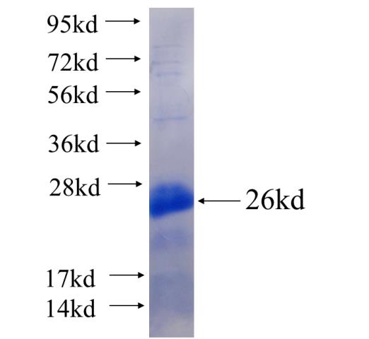 Recombinant human TBX18 SDS-PAGE