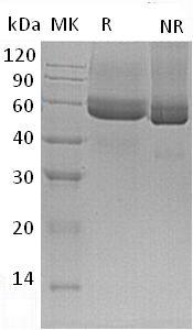 Mouse Spock3 (His tag) recombinant protein