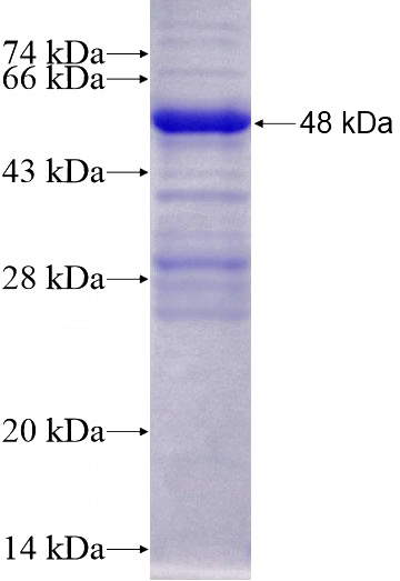 Recombinant Mouse H2-K1 SDS-PAGE