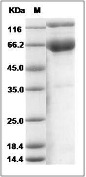 Human Epcr / PROCR Protein (Fc Tag) SDS-PAGE