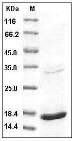 Human TNF-alpha / TNFA Protein SDS-PAGE