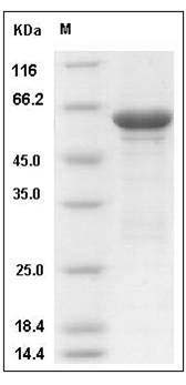 Human ALDOB / Aldolase B Protein GST Tag SDS-PAGE