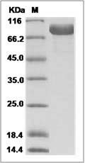 Human KIRREL2 / NEPH3 Protein (Fc Tag)
