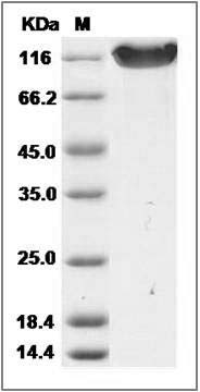 Rat NCAM1 / CD56 Protein (His Tag) SDS-PAGE