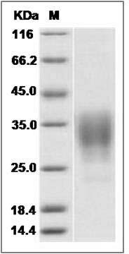 Rat CD153 / CD30L / TNFSF8 Protein SDS-PAGE