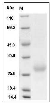 Mouse NBL1 / DAND1 / DAN Protein (His Tag) SDS-PAGE