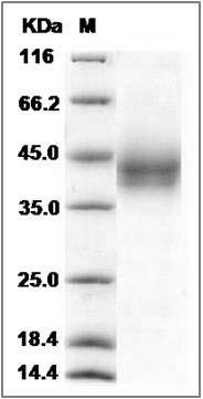 Rat B7-H3 / CD276 Protein (His Tag) SDS-PAGE