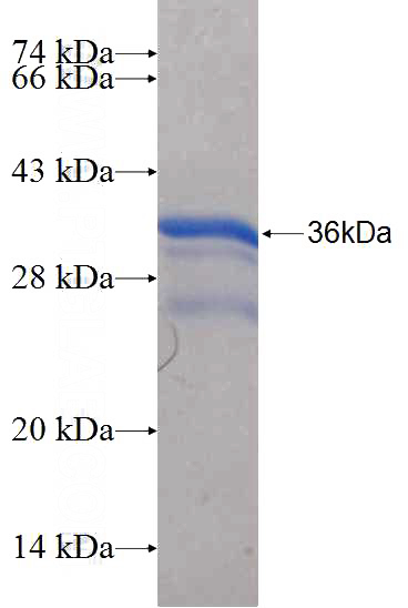 Recombinant Human Myogenin SDS-PAGE