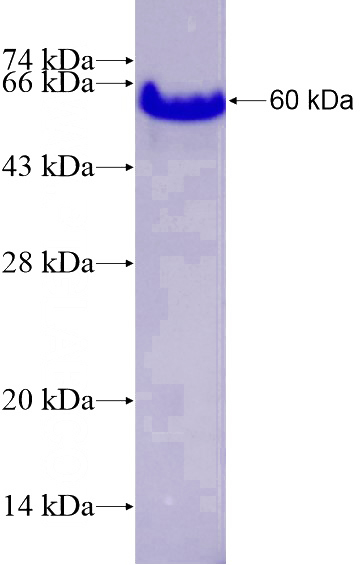 Recombinant Human MEIS2 SDS-PAGE