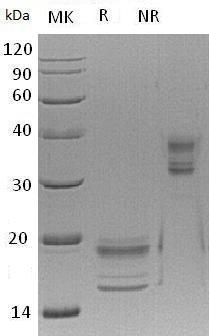 Human IL-17A & IL-17F (His tag) recombinant protein