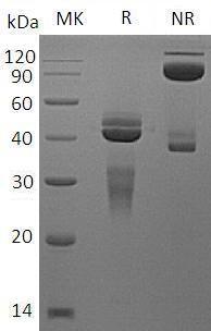 Rat IL-12 (His tag) recombinant protein