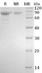 Human SERPINA10/ZPI/UNQ707/PRO1358 (His tag) recombinant protein