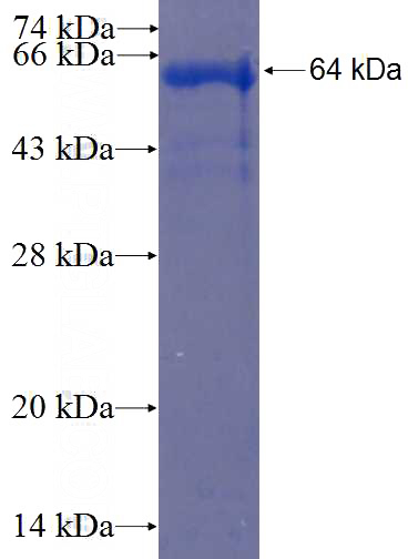 Recombinant Human PRDM8 SDS-PAGE
