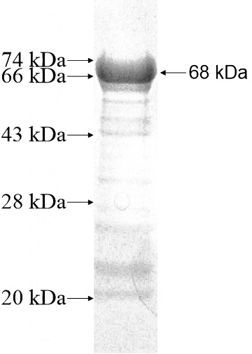 Recombinant Human CUEDC1 SDS-PAGE