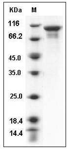 Human STK16 / PKL12 / MPSK Protein (His & NusA Tag) SDS-PAGE