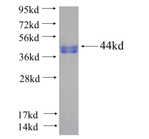 Recombinant human DAXX SDS-PAGE