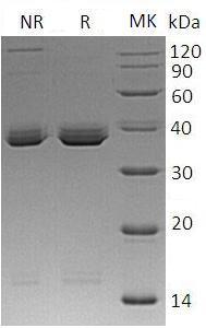 Human CHRNB3 (His tag) recombinant protein