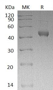Human NEU1/NANH (His tag) recombinant protein