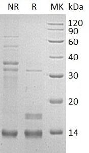 Human CD72 (Trx & His tag) recombinant protein