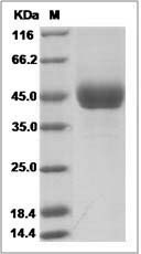 Influenza A H6N6 (A/duck/Eastern China/11/2009) Hemagglutinin / HA1 Protein (His Tag)