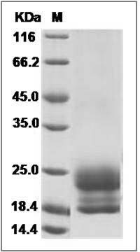 Human Niemann-Pick disease type C2 / NPC2 Protein (His Tag) SDS-PAGE