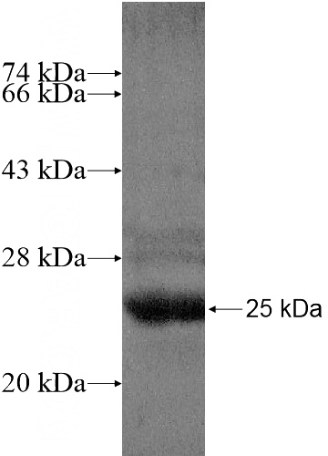 Recombinant Human EIF1AD SDS-PAGE