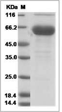 Rat FOLR1 / Folate Receptor 1 Protein (Fc Tag)