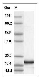 Human IFN?4 / IFNa4 / Interferon alpha-4 Protein (His Tag) SDS-PAGE