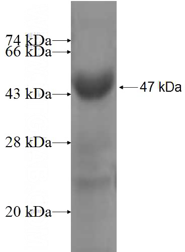 Recombinant Human TYSND1 SDS-PAGE
