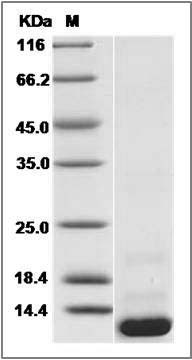 Human BOLA1 Protein (His Tag) SDS-PAGE
