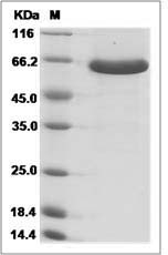 Mouse Semaphorin 3A / SEMA3A Protein (His Tag)