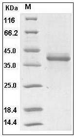 Human S100A1 Protein (Fc Tag) SDS-PAGE