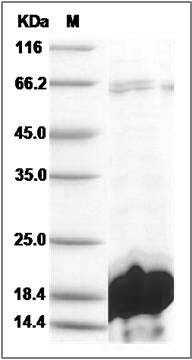 Human IBA1 / AIF1 Protein (His Tag) SDS-PAGE
