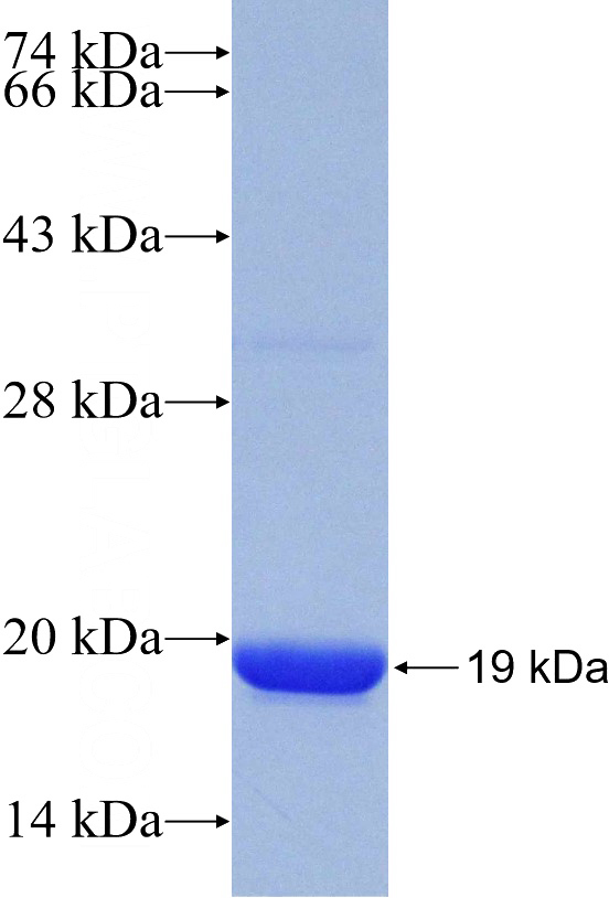 Recombinant Human CYP20A1 SDS-PAGE