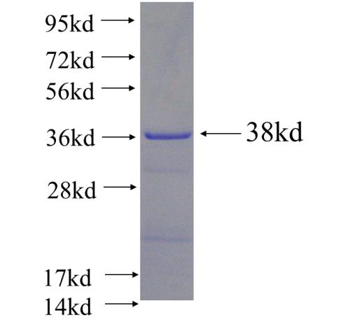 Recombinant Arabidopsis thaliana AtIAA17 SDS-PAGE