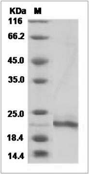 Cynomolgus / Rhesus IFNA14 / Interferon alpha-14 Protein (His Tag) SDS-PAGE