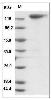 Mouse MERTK / Mer Protein (Fc Tag) SDS-PAGE