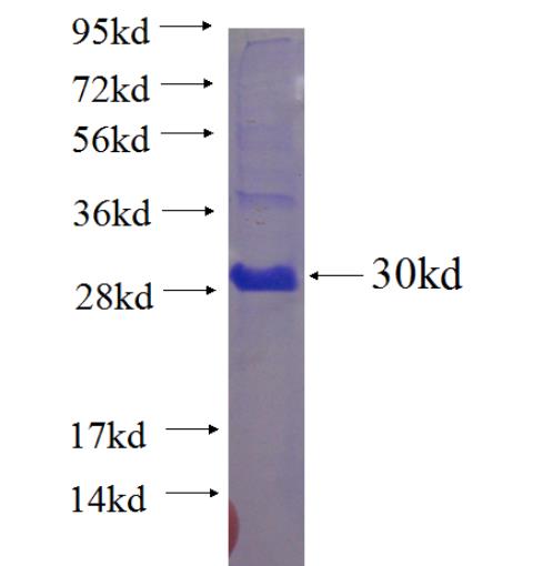 Recombinant human IGSF9 SDS-PAGE