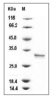 Human CUTC / CGI-32 Protein (His Tag) SDS-PAGE